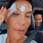 Com olho roxo, Ivete recebe alta de hospital em Salvador e explica quadro de saúde